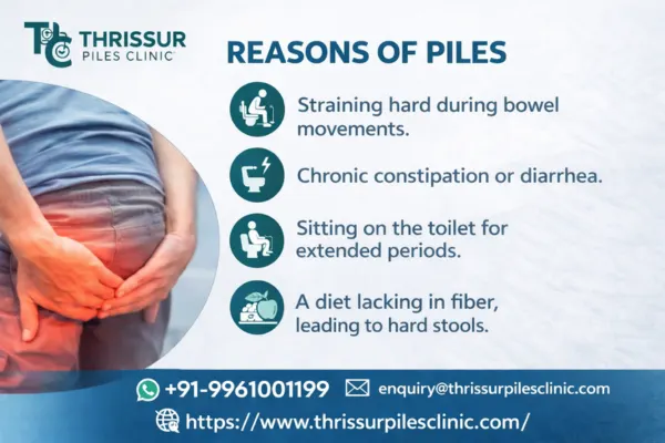 Reasons of piles including straining during bowel movements, chronic constipation, prolonged toilet sitting and low fiber diet – Thrissur Piles Clinic