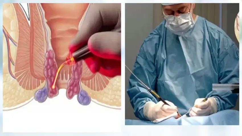Laser vs Traditional Surgery comparison for piles, fistula, and fissure treatment in Thrissur