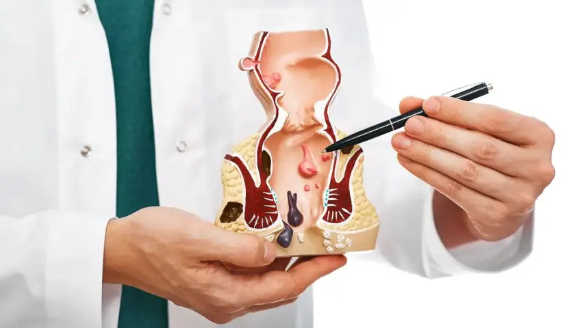 Modern Fistula Care in Kerala – Advanced fistula treatment and laser fistula procedure by Dr. Raviram S at Thrissur Piles Clinic