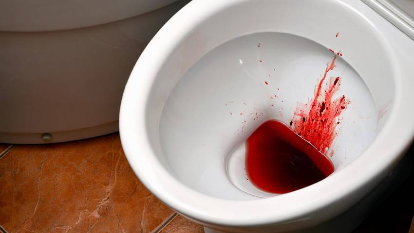Baby blood in stool treatment in Thrissur by Dr. Raviram S. at Thrissur Piles Clinic