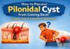 Dr. Raviram S., Pilonidal Sinus Specialist at Thrissur Piles Clinic, explaining how to prevent pilonidal cyst from coming back.